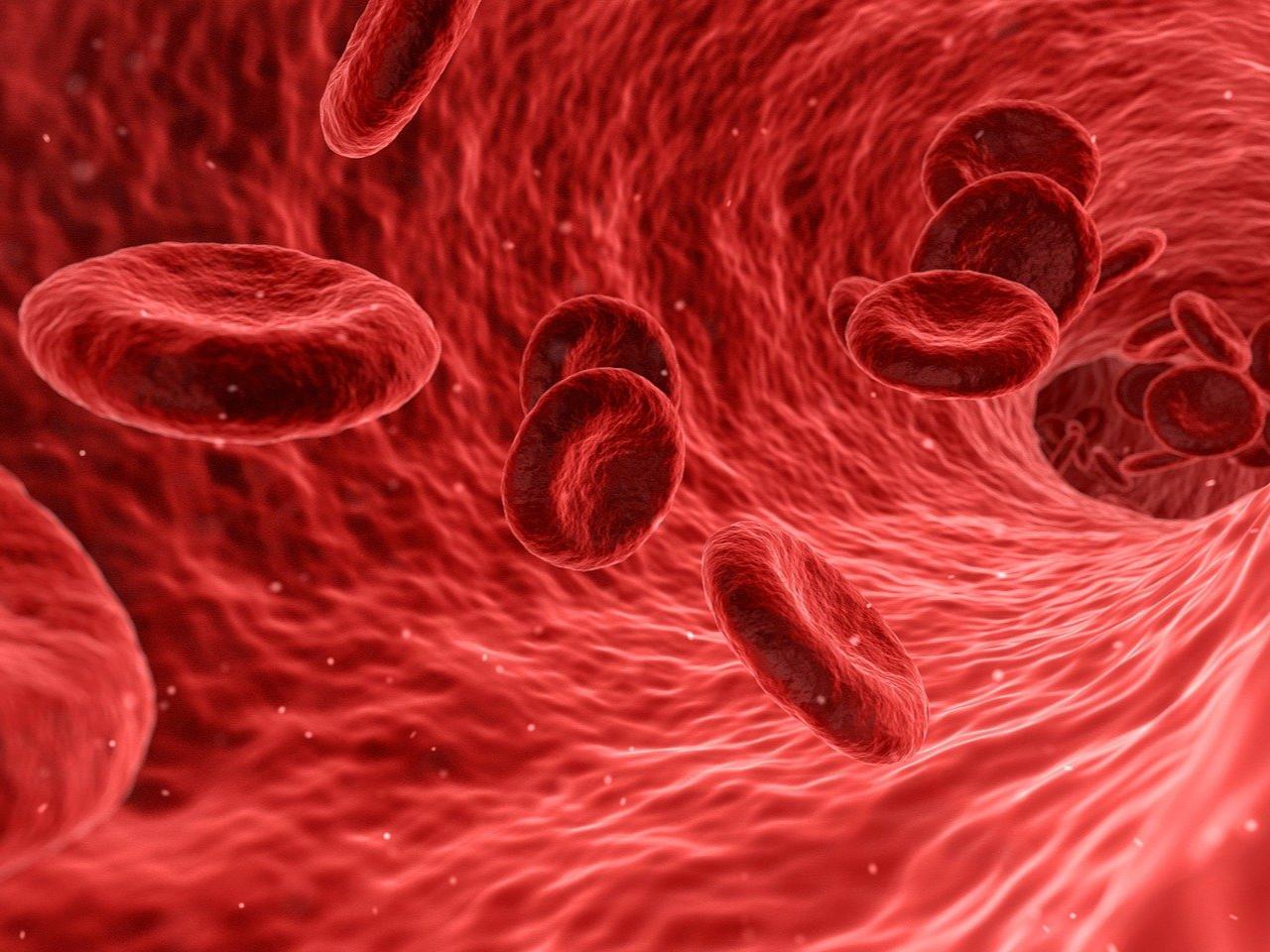 MCV - makrocytoza i mikrocytoza